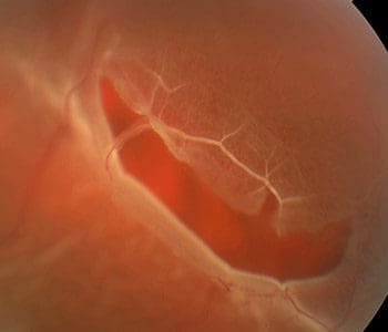 A close up of the inside of an eye